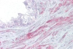 TRPM8 Rabbit anti-Human, Polyclonal, Novus Biologicals:Antibodies:Primary